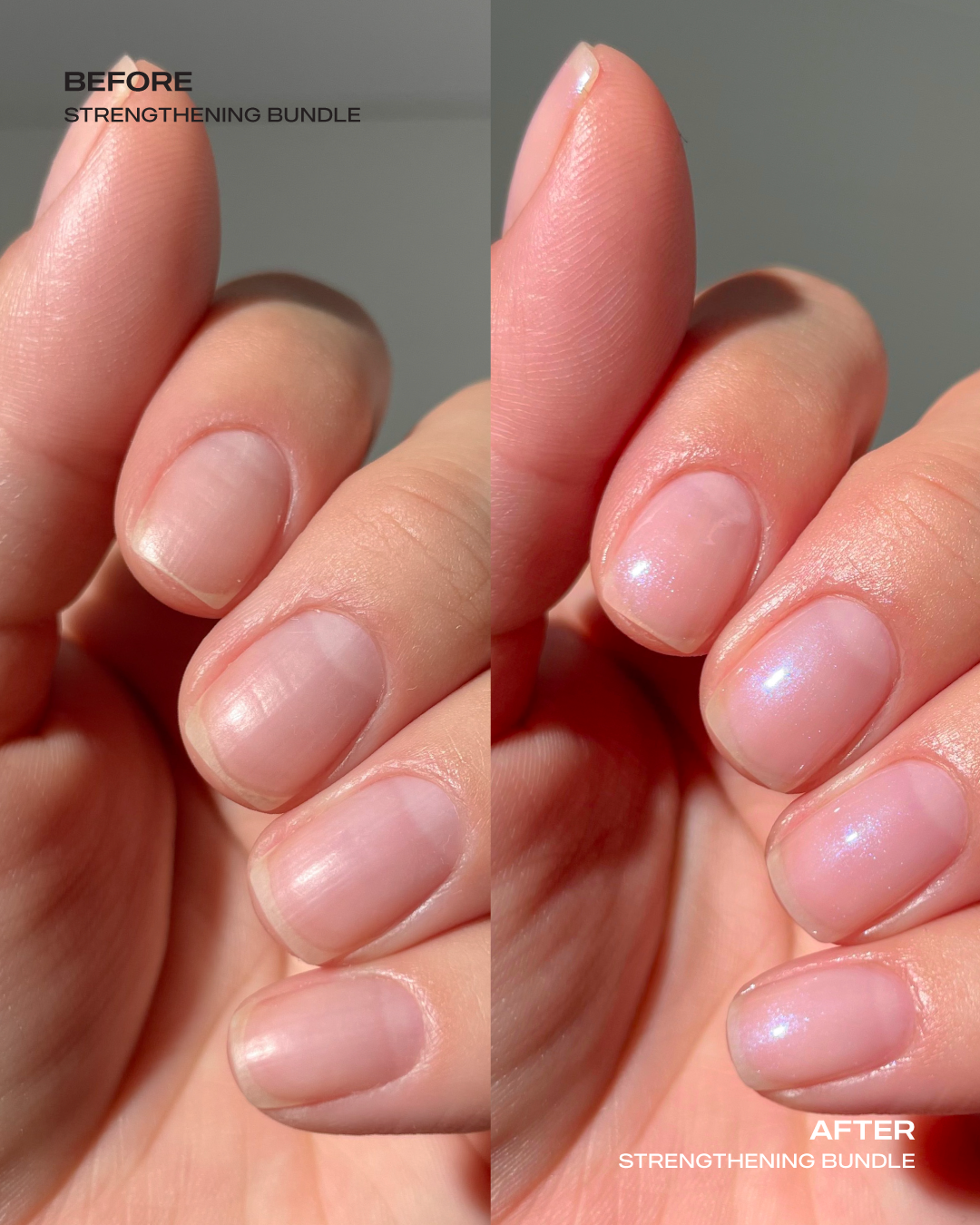 Strengthening Bundle